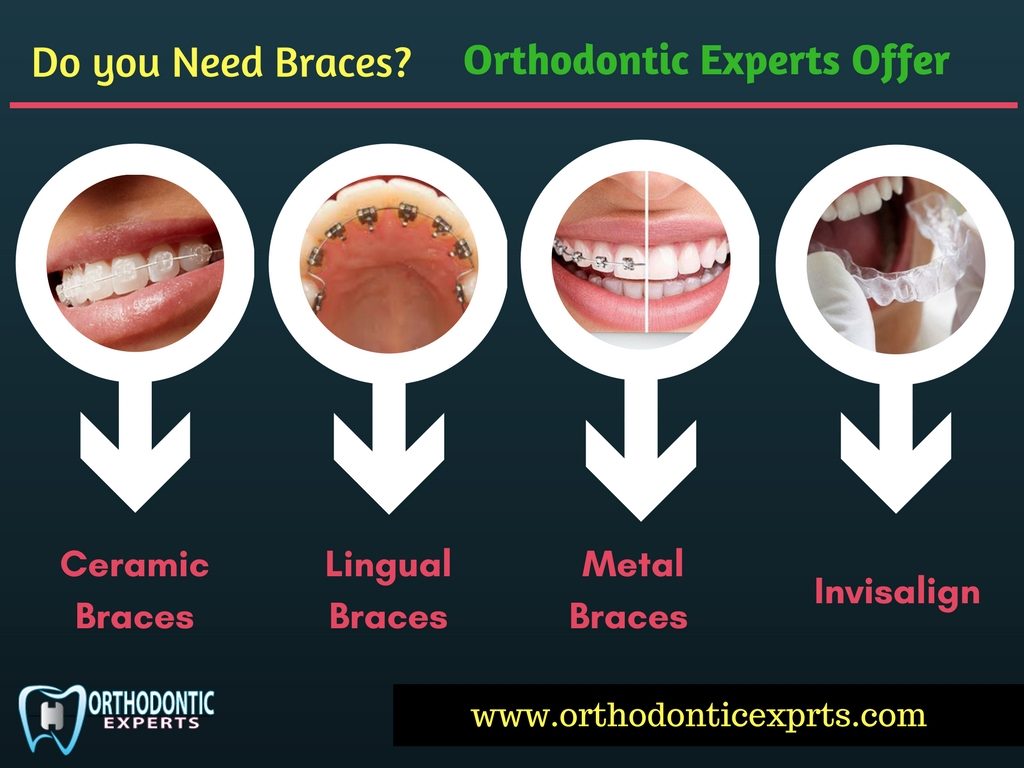 Orthodontic Experts pic Siachen